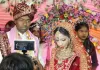 दुल्हन की सफल सर्जरी : स्टेज पर दूल्हे को जयमाला पहनाते समय सिरफिरे ने मारी थी गोली