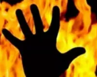 पेट्रोल डालकर पति को फूंक दिया जिन्दा, हालत गंभीर