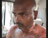 Ballia में बड़े भाई ने कर दिया कांड, छोटा रेफर