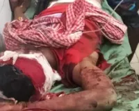 बल‍िया में मामा पर चाकू से दनादन वार, आरोपी भांजा गिरफ्तार