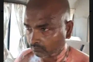 Ballia में बड़े भाई ने कर दिया कांड, छोटा रेफर