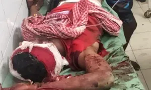 बल‍िया में मामा पर चाकू से दनादन वार, आरोपी भांजा गिरफ्तार