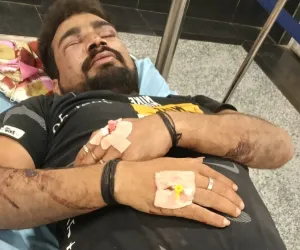 बलिया में तीन जगह मारपीट, आठ घायलों में पांच रेफर ; दो गिरफ्तार